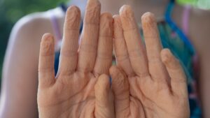 Fingers Wrinkle in Water